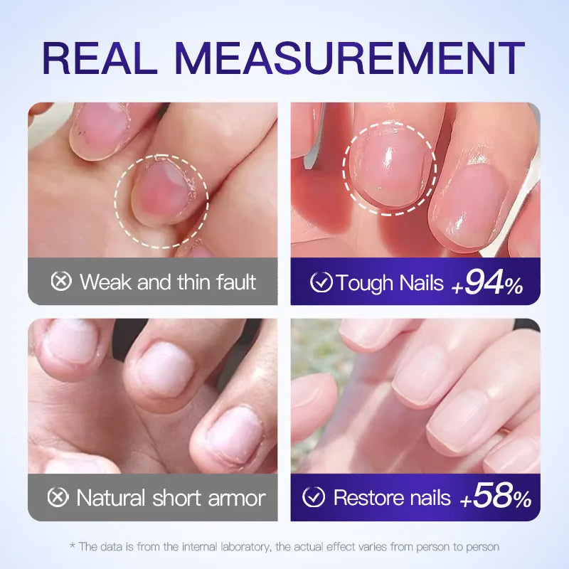 Cross-border Foreign Trade Wholesale Essence for Moisturizing, Nail Care, Skin Rejuvenation and Hydration